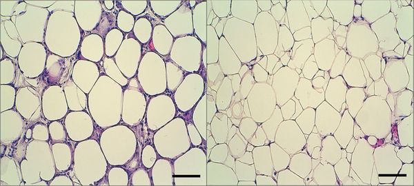 간특이적 RORa 결손조직 지방조직(좌측), 정상쥐 지방조직