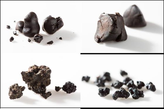 ▲ 그림 3. 다양한 형태의 흑색의 빌리루빈 담석 (Various types of black pigment stones)