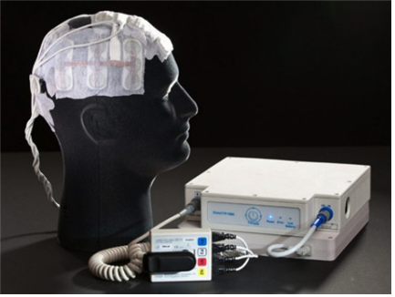 ▲ 전기장 종양치료기를 머리에 착용한 모형과 주변 장치. 이 장치는 휴대할 수 있고, 일반 전원으로 충전 가능하다. 현재 미국에서는 FDA 승인 하에 교모세포종 환자의 치료에 쓰이고 있다.