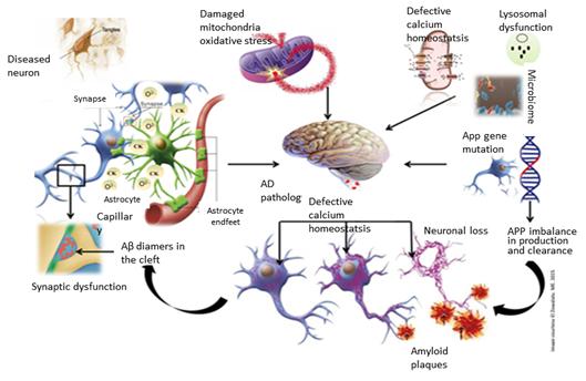 Figure 5. Schematic representation of the pathology of Alzheimer’s disease depicting the multifactorial perplexed feature of AD disease / 출처: FCDR-Alzheimer Disorder, 2016, Vol. 5, 3-33