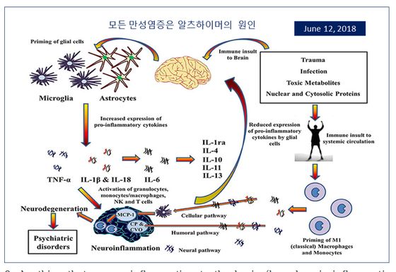 ▲ 그림2. Anything that causes inflammation to the brain can contribute to Alzheimer's Disease./ 출처 : mybiohack.com/blog/dale-bredesen-protocol-recode-alzheimers-mend