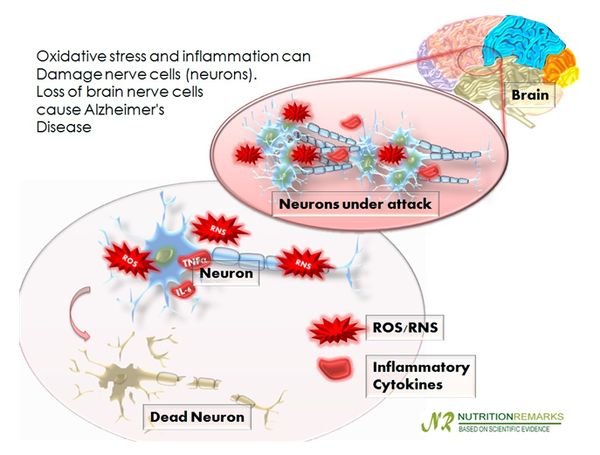 ▲ 그림 4. Oxidative stress and inflammation can damage neurons loss ofbrain nerve cells cause Alzheimer’s disease. 출처 : Nutrition Remarks, April 11, 2013