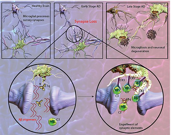 ▲ 그림 6. Schematic representation of Aβ-mediated synapse loss./ 출처: https://www.biolegend.com/microglia