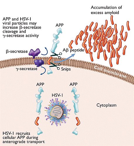 ▲ 그림 3. Links herpes viruses to Alzheimer’s diseases  출: Life Enhancement Magazine, July 2011