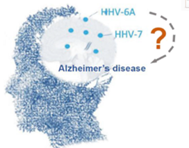▲그림 4. Schematic of human brain tissue of Alzheimer’ disease with HHV-6A and HHV-7 infection.