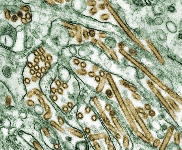 조류인플루엔자 현미경 사진
