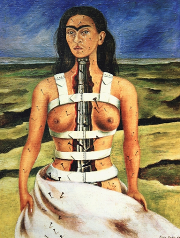 칼로 작: ‘골절된 척추’ 1944, 멕시코시티, 로레스 올메드 파티노 미술관